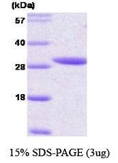 NBC1-18392 - 14-3-3 protein epsilon